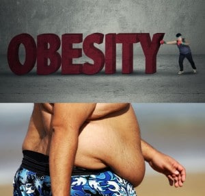 obesity66
